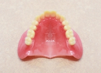 レジン床義歯 （保険適用）