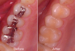 e.max (イーマックス)