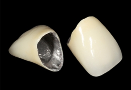 メタルボンド・クラウン